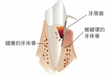 你一定要到牙周科看看